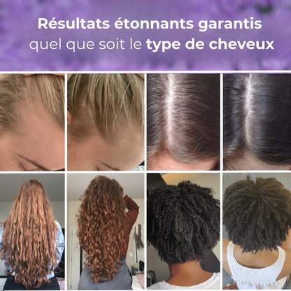 HairPulse - Brosse LED repousse cheveux
