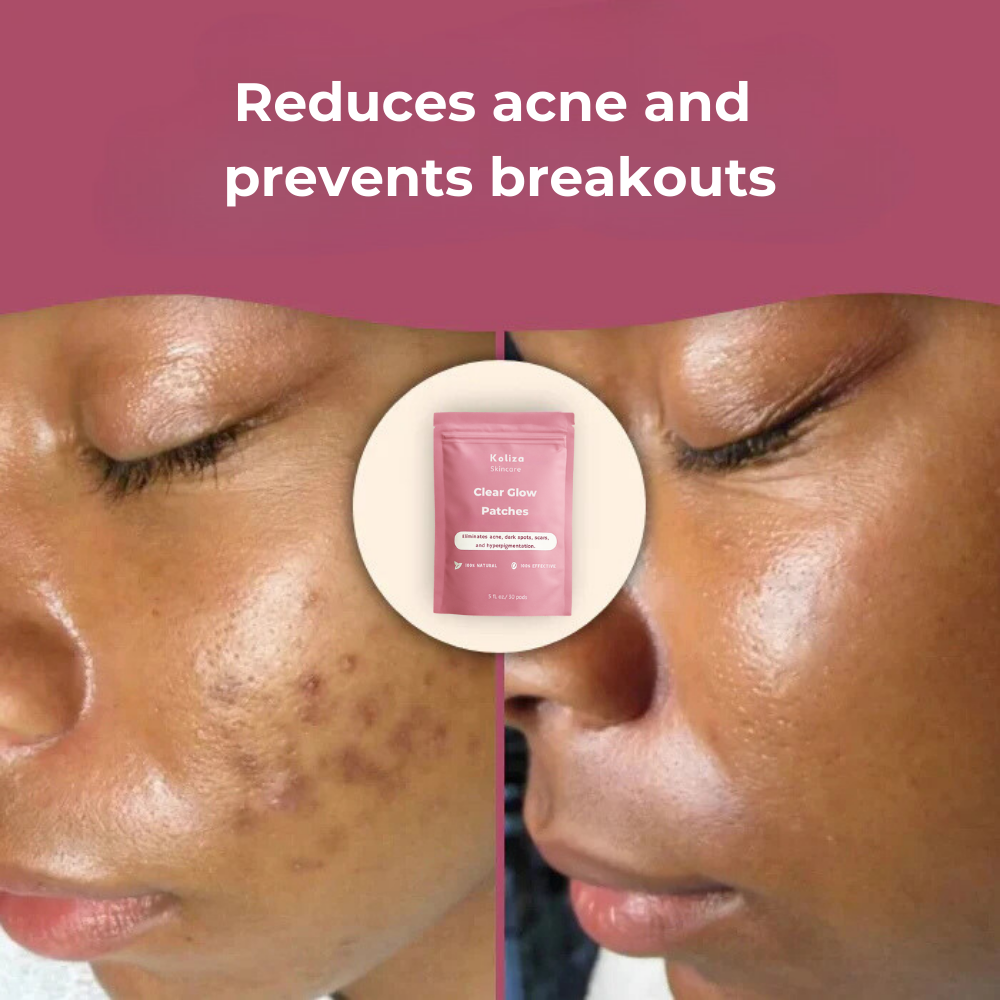 ClearGlow™ Patches – For smooth, clear, and radiant skin