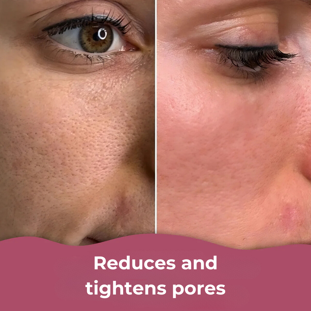 ClearGlow™ Patches – For smooth, clear, and radiant skin