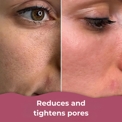 ClearGlow™ Patches – For smooth, clear, and radiant skin