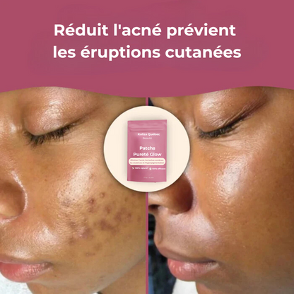 Cotons nettoyants Pureté Glow – Pour une peau lisse, pure et éclatante